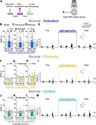 Optogenetic Manipulations of Amygdala Neurons Modulate Spinal Nociceptive Processing and Behavior Under Normal Conditions and in an Arthritis Pain Model